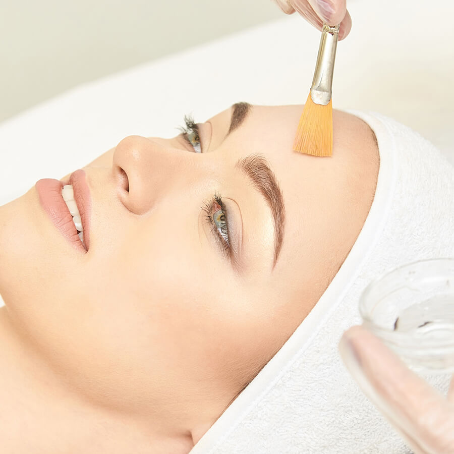 Chemical Peel Sacramento