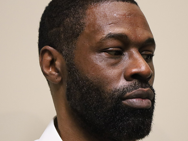 Rhinoplasty Patient 48 After 1