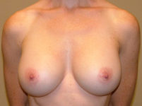 After Image