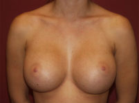 After Image