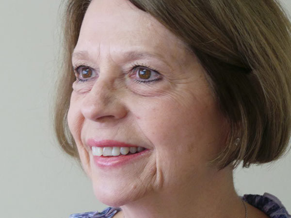 Eyelid Surgery Patient 10 Before 2