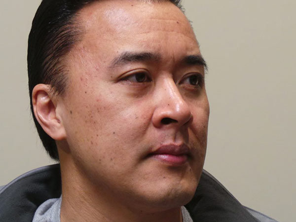 Eyelid Surgery Patient 14 After 2