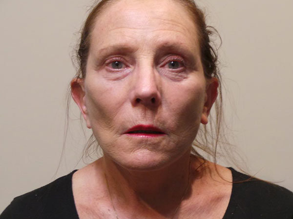 Facelift Patient 08 After 1