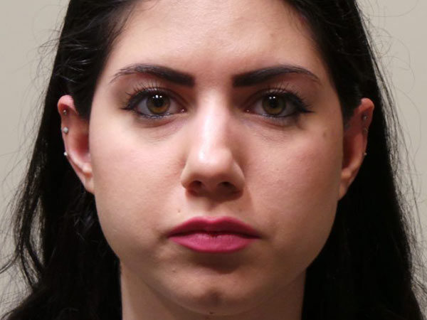 Rhinoplasty Patient 07 Before 1